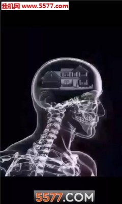 抖音脑子ct图里面全是你表情包